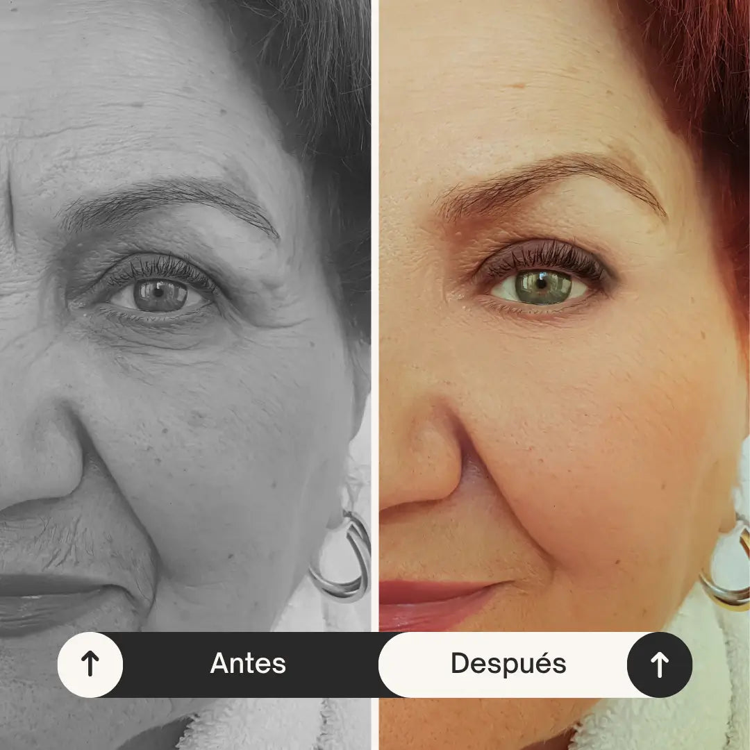 LiftPRO™ 40 Parches Faciales Invisibles · Define tu contorno en segundos