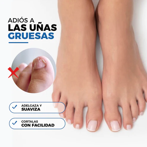 UÑAS SIN VERGÜENZA Tratamiento AntiHongo 2x1